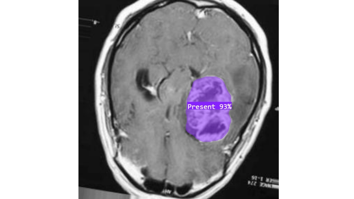 phân đoạn hình ảnh bằng Vertex AI